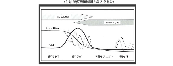 만성 B형 간염바이러스의 자연경과 도표