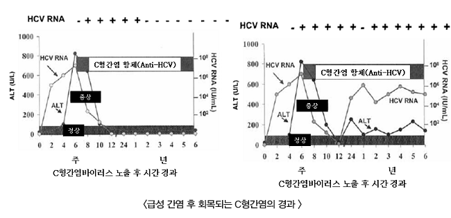C형간염 자연경과 도표